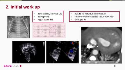 Presentation thumbnail