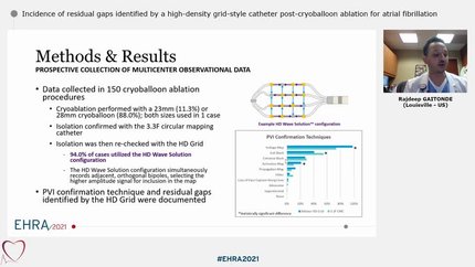 Incidence of residual gaps identified by a high-density grid-style catheter post-cryoballoon ablation for atrial fibrillation