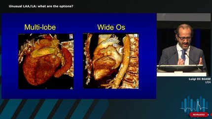 Presentation thumbnail