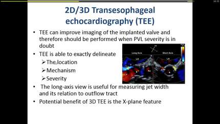 Presentation thumbnail