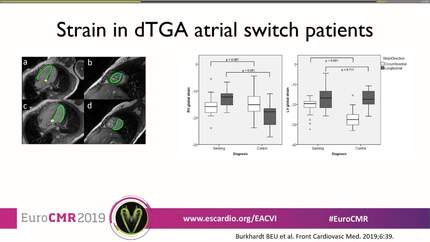 Ventricular function for congenital heart disease (advanced).