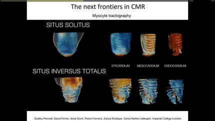 Presentation thumbnail