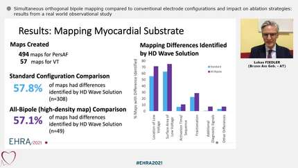 Simultaneous orthogonal bipole mapping compared to conventional electrode configurations and impact on ablation strategies: results from a real world observational study