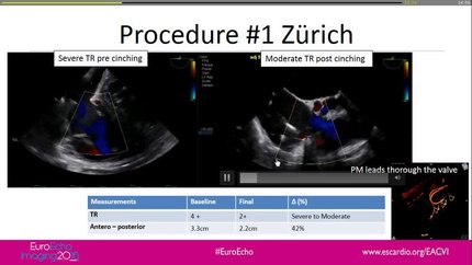 Presentation thumbnail