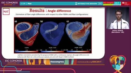Non-invasive virtual prediction of site of origin in outflow tract ventricular arrhythmias with a patient-specific computational model