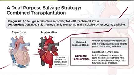 Combined heart and ascending aorta transplantation: a novel salvage strategy for acute type a dissection following lvad implantation