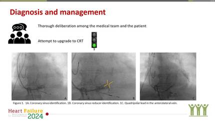 Overcoming challenges: CRT implantation following coronary sinus reduction – a viable option in 2024