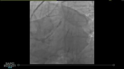 Presentation thumbnail