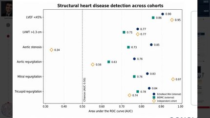 Multimodal ECG–language contrastive pretraining enables detection of structural heart disease from 12-Lead ECG
