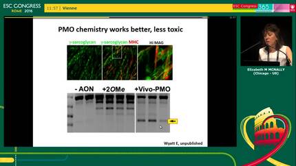 Gene-editing  in hypertrophic cardiomyopathy