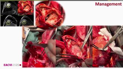 Presentation thumbnail