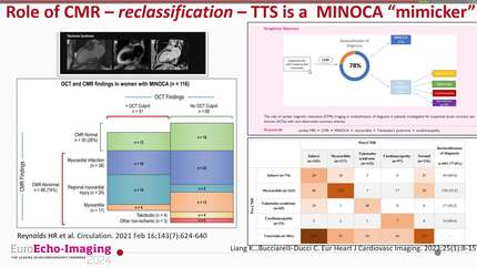 Cardiovascular imaging in women 
