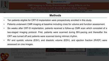 CMR imaging to study biventricular pacing effects on the right ventricle in left bundle branch block patients