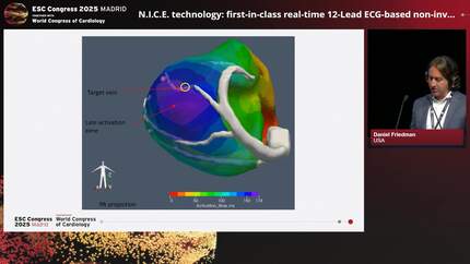 New generation of non-invasive cardiac mapping: real-time electroanatomic (ECG) insights from 12-lead electrocardiogram