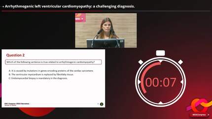 Arrhythmogenic left ventricular cardiomyopathy: a challenging diagnosis.