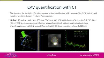 Coronary CT angiography for the assessment of cardiac allograft vasculopathy after heart transplantation