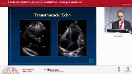 ESC 365 - A case of constriction versus restriction - How I did image