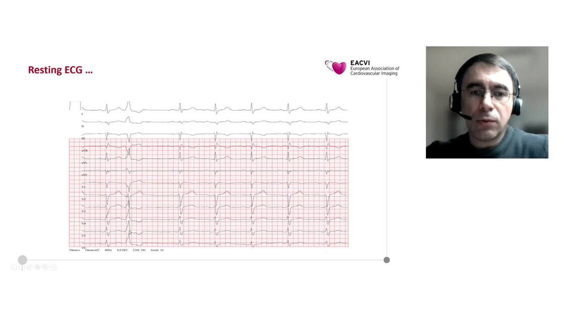 ESC 365 - The role of cardiac magnetic resonance for patients with ...