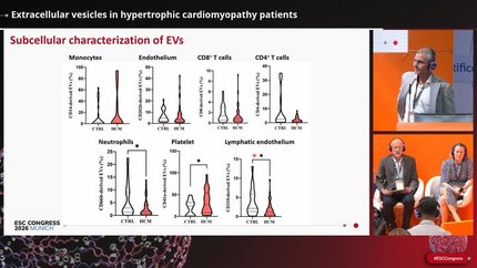 Extracellular vesicles in hypertrophic cardiomyopathy patients
