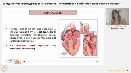 Hypertrophic cardiomyopathy and comorbidities. The importance of heart-team in off label recommendations.