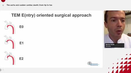 The aorta and sudden cardiac death: from tip to toe