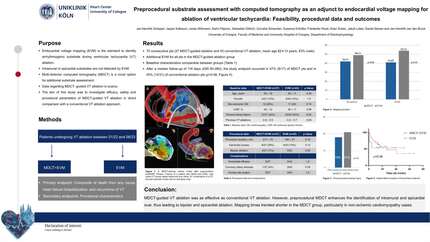 Preprocedural substrate assessment with computed tomography as an adjunct to endocardial voltage mapping for ablation of ventricular tachycardia: feasibility, procedural data and outcomes