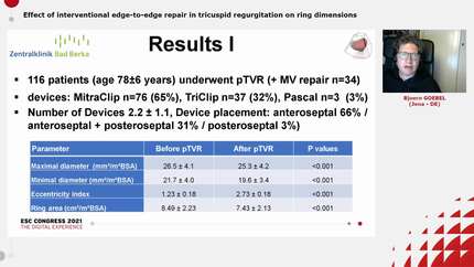 Effect of interventional edge-to-edge repair in tricuspid regurgitation on ring dimensions