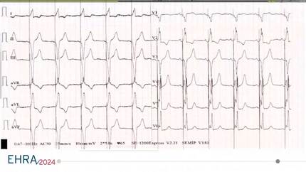 Presentation thumbnail