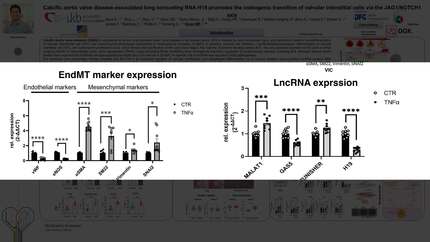 Calcific aortic valve disease-associated long noncoding RNA H19 promotes the osteogenic transition of valvular interstitial cells via the JAG1/NOTCH1 axis