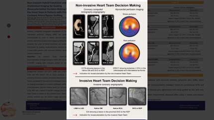 The value of hybrid functional and anatomical imaging for guiding revascularization decision-making by the heart team in patients with prior coronary artery bypass grafting