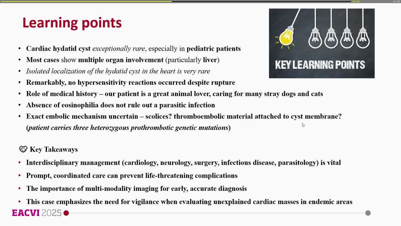 Unexpected intracardiac mass in a pediatric patient: hydatid cyst as a rare etiology