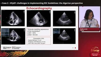 Heart failure in real life: insights from Algeria
