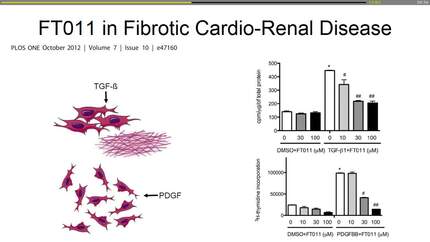 Krum lecture - Scar Wars: the role of anti-fibrotic therapies in heart failure