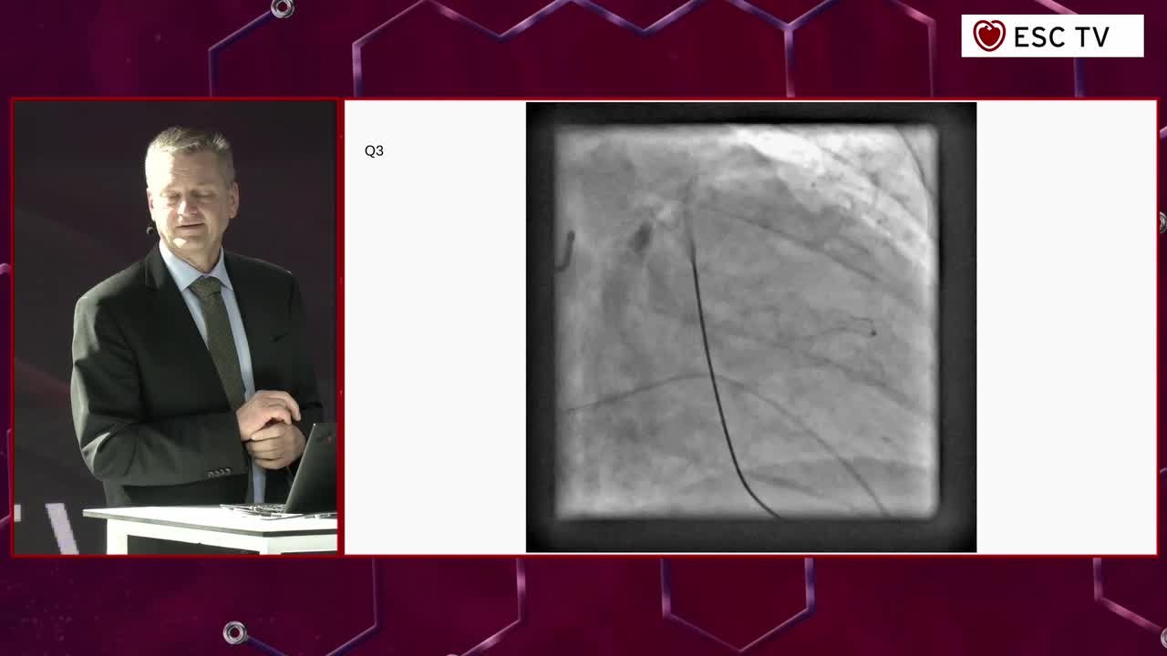 The Great (Interactive) Cardiology Extravaganza