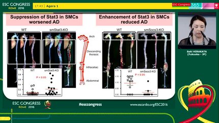 STAT3 in vascular smooth muscle cells protects aorta from dissection by reinforcing extracellular matrix
