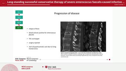 Long-standing successful conservative therapy of severe enterococcus faecalis-caused infective prosthetic aortic valve endocarditis with valve ring abscess, concomitant spondylodiscitis and multi-organ septic embolisms in a multi-morbid 84-year old patien
