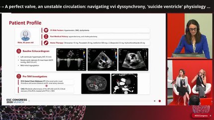 Aortic valve interventions in challenging scenarios 