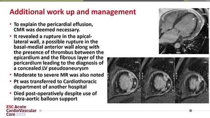 Presentation thumbnail