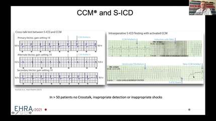 Adopting CCM therapy into practice - Referral to implant.
