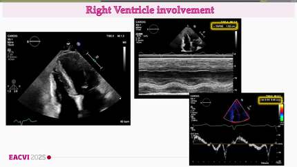 Presentation thumbnail