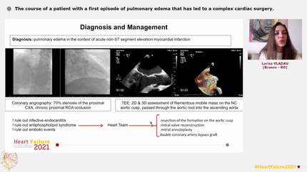 The course of a patient with a first episode of pulmonary edema that has led to a complex cardiac surgery.
