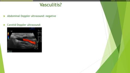 Diagnostic difficulties of a vasculitis caused by uncommon cardiovascular manifestation