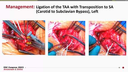 Presentation thumbnail