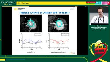 Local spared hypertrophy in pressure overloaded hearts promote severe systolic dysfunction