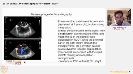 An unusual and challenging case of Heart failure.