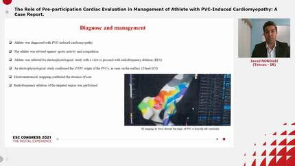The Role of Pre-participation Cardiac Evaluation in Management of Athlete with PVC-Induced Cardiomyopathy: A Case Report.
