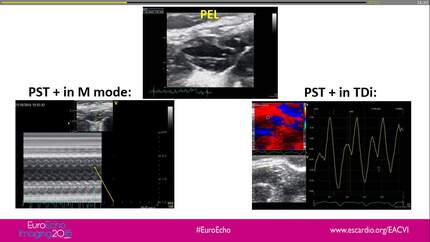 Presentation thumbnail