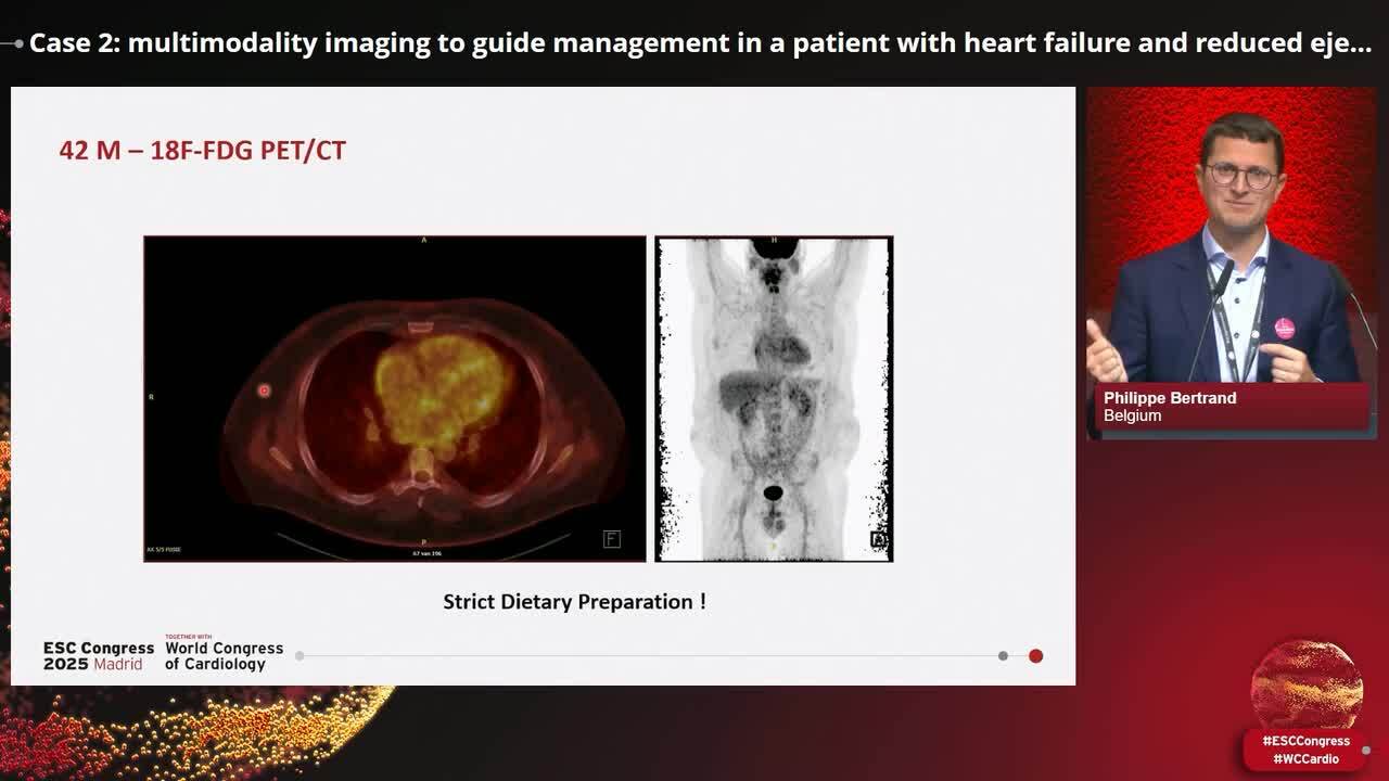 Clinical Case Management: multimodality imaging to guide management of heart failure 