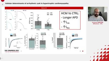 Cellular determinants of arrhythmic rysk in hypertrophic cardiomyopathy