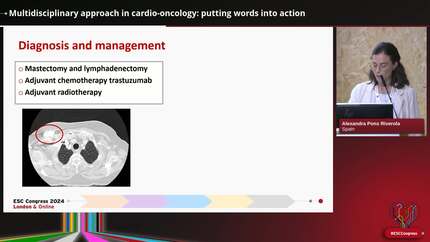Multidisciplinary approach in cardio-oncology: putting words into action